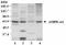 Protein Kinase AMP-Activated Catalytic Subunit Alpha 1 antibody, GTX23759, GeneTex, Western Blot image 