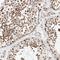 Histone Deacetylase 9 antibody, HPA028926, Atlas Antibodies, Immunohistochemistry frozen image 