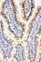 Peroxiredoxin 3 antibody, LS-C312980, Lifespan Biosciences, Immunohistochemistry paraffin image 