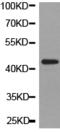Alcohol Dehydrogenase 5 (Class III), Chi Polypeptide antibody, TA321174, Origene, Western Blot image 