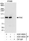 Protein Tyrosine Kinase 2 antibody, A301-692A, Bethyl Labs, Immunoprecipitation image 