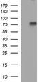 Tumor Protein P73 antibody, TA506474, Origene, Western Blot image 