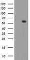 Dystrobrevin Alpha antibody, LS-C337197, Lifespan Biosciences, Western Blot image 