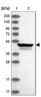 Zinc Finger Protein 774 antibody, NBP1-92617, Novus Biologicals, Western Blot image 