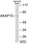 A-Kinase Anchoring Protein 10 antibody, EKC1633, Boster Biological Technology, Western Blot image 