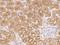Cilia And Flagella Associated Protein 410 antibody, 205710-T08, Sino Biological, Immunohistochemistry paraffin image 