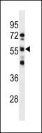 RNA Binding Motif Protein, Y-Linked, Family 1, Member D antibody, 60-280, ProSci, Western Blot image 