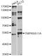 Transmembrane Serine Protease 11A antibody, A14167, ABclonal Technology, Western Blot image 