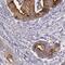 Beta 3-Glucosyltransferase antibody, FNab00767, FineTest, Immunohistochemistry paraffin image 