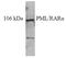 Promyelocytic Leukemia antibody, AP32356PU-N, Origene, Western Blot image 