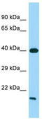 G Protein-Coupled Receptor 21 antibody, TA333946, Origene, Western Blot image 