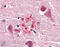 Polyubiquitin-B antibody, ADI-SPA-200-F, Enzo Life Sciences, Immunohistochemistry paraffin image 
