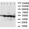 Branched Chain Amino Acid Transaminase 2 antibody, orb47969, Biorbyt, Western Blot image 