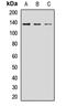 PTPRF Interacting Protein Alpha 1 antibody, LS-C668186, Lifespan Biosciences, Western Blot image 
