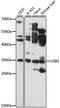 U6 snRNA phosphodiesterase antibody, LS-C748288, Lifespan Biosciences, Western Blot image 