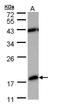 Phosphodiesterase 6D antibody, orb73828, Biorbyt, Western Blot image 