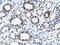 Quinolinate Phosphoribosyltransferase antibody, LS-C115491, Lifespan Biosciences, Immunohistochemistry paraffin image 
