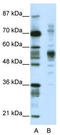 Coronin 1A antibody, TA343656, Origene, Western Blot image 