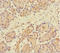 Family With Sequence Similarity 117 Member B antibody, A65578-100, Epigentek, Immunohistochemistry paraffin image 