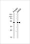 Chimerin 1 antibody, LS-C157639, Lifespan Biosciences, Western Blot image 