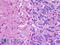 NLR Family Pyrin Domain Containing 8 antibody, LS-B6191, Lifespan Biosciences, Immunohistochemistry paraffin image 