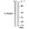 T-Box 1 antibody, A02871, Boster Biological Technology, Western Blot image 