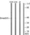 HsMAD2 antibody, LS-B9864, Lifespan Biosciences, Western Blot image 