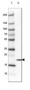 HMGN1 antibody, NBP2-47433, Novus Biologicals, Western Blot image 