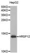 PSP1 antibody, abx003274, Abbexa, Western Blot image 