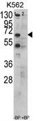 Chaperonin Containing TCP1 Subunit 3 antibody, AP17199PU-N, Origene, Western Blot image 