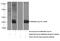Serologically defined colon cancer antigen 8 antibody, 13471-1-AP, Proteintech Group, Western Blot image 