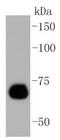 Caldesmon 1 antibody, NBP2-67458, Novus Biologicals, Western Blot image 