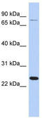 Ribosomal Protein S7 antibody, TA336119, Origene, Western Blot image 