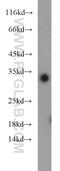 Inhibitor Of Growth Family Member 5 antibody, 10665-1-AP, Proteintech Group, Western Blot image 