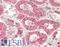 PR domain zinc finger protein 13 antibody, LS-B13785, Lifespan Biosciences, Immunohistochemistry paraffin image 