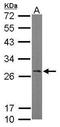 RAN Binding Protein 1 antibody, TA308769, Origene, Western Blot image 
