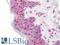 Zinc Finger Matrin-Type 2 antibody, LS-C211373, Lifespan Biosciences, Immunohistochemistry paraffin image 
