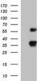 Ubiquitin-conjugating enzyme E2 S antibody, TA590247, Origene, Western Blot image 