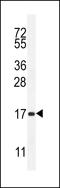 Sperm Acrosome Associated 5B antibody, LS-C161419, Lifespan Biosciences, Western Blot image 