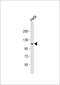 SEC24 Homolog D, COPII Coat Complex Component antibody, 61-274, ProSci, Western Blot image 