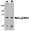 Sialic acid-binding Ig-like lectin 15 antibody, LS-B8808, Lifespan Biosciences, Western Blot image 