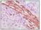 Vimentin antibody, LS-C171373, Lifespan Biosciences, Immunohistochemistry paraffin image 