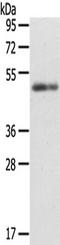 Cholecystokinin B Receptor antibody, TA321943, Origene, Western Blot image 