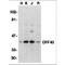DNA Fragmentation Factor Subunit Beta antibody, TA305993, Origene, Western Blot image 