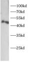 2'-5'-Oligoadenylate Synthetase 1 antibody, FNab10795, FineTest, Western Blot image 