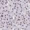 Zinc Finger RANBP2-Type Containing 2 antibody, HPA063298, Atlas Antibodies, Immunohistochemistry frozen image 
