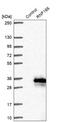 Neisseria gonorrhoeae MOMP antibody, NBP1-81203, Novus Biologicals, Western Blot image 