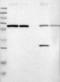 Ribophorin II antibody, TA590669, Origene, Western Blot image 