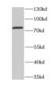 Cholesteryl Ester Transfer Protein antibody, FNab01619, FineTest, Western Blot image 