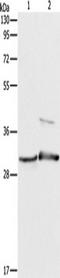 Apolipoprotein B MRNA Editing Enzyme Catalytic Subunit 2 antibody, TA350862, Origene, Western Blot image 